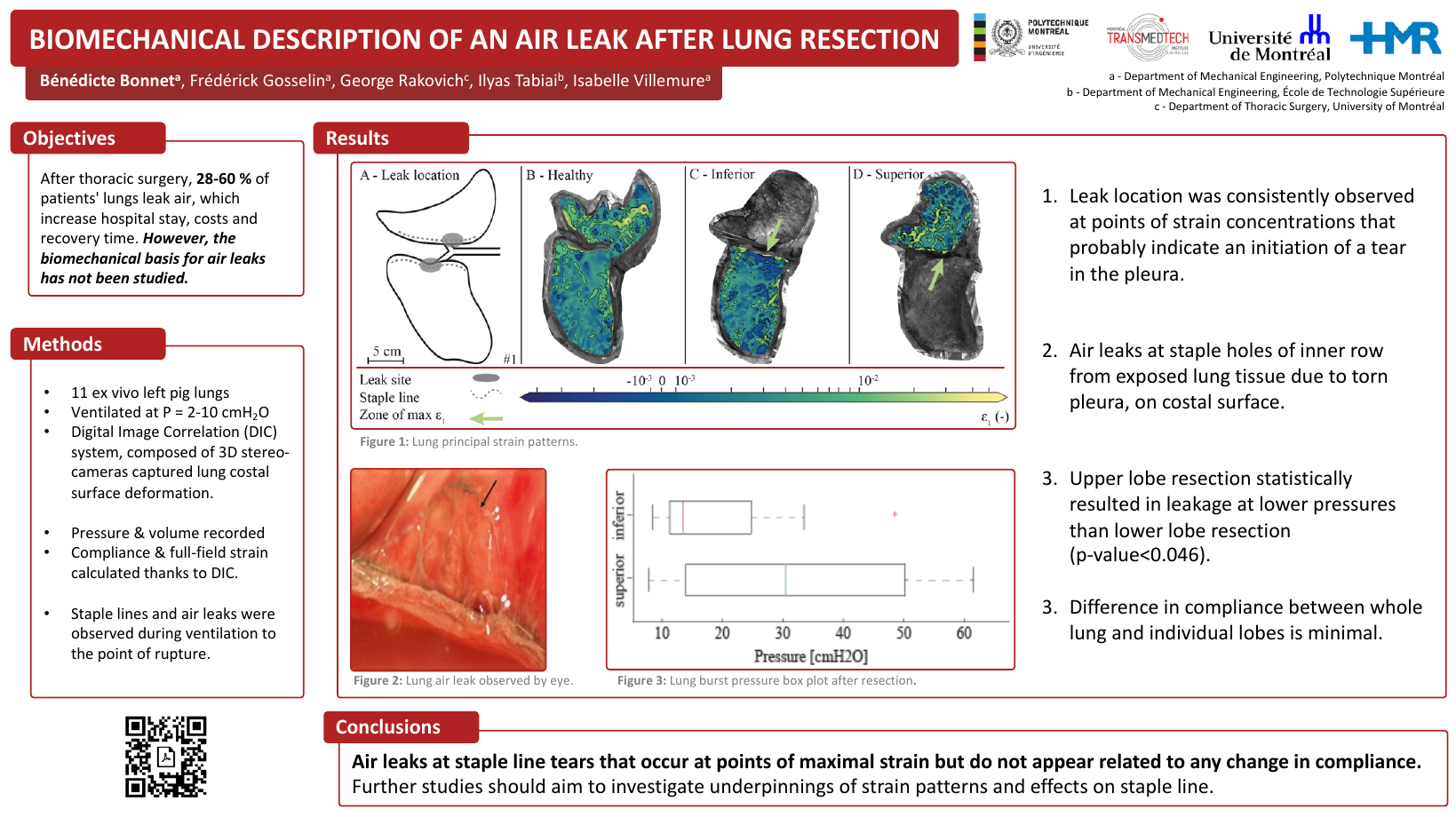 Lungs poster